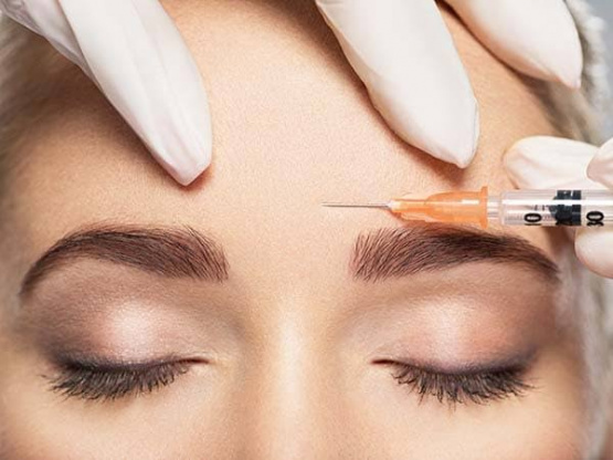 Botox: la verdad incómoda que te mira desde el espejo (y nadie te explica)